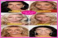 Botox, Implants & More! – Hollywood Life